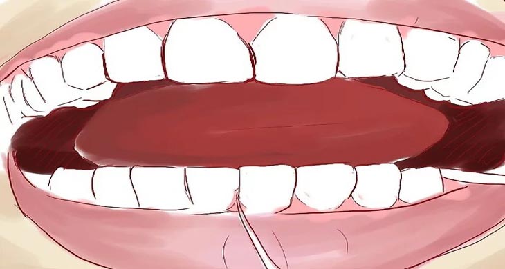 جایگزین نخ دندان