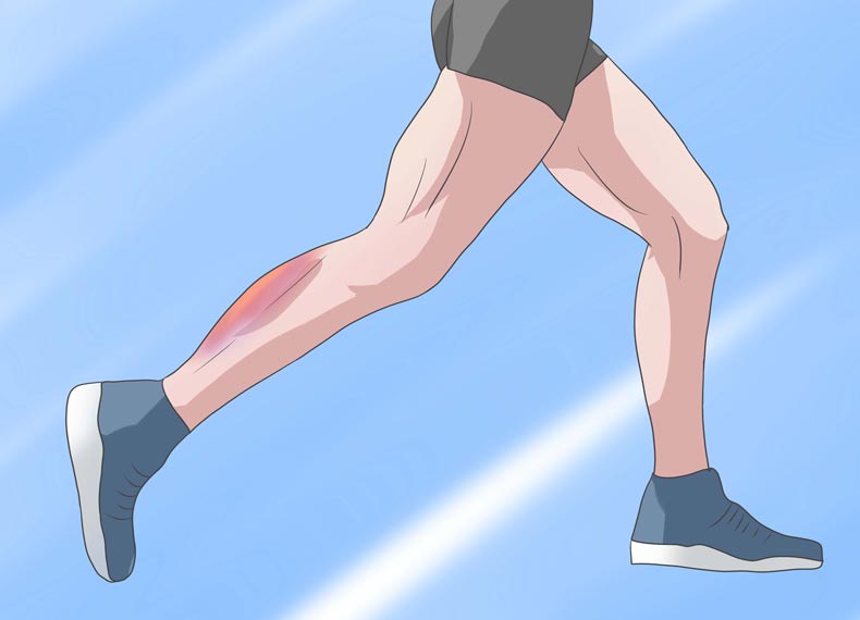 درمان کوفتگی ساق پا