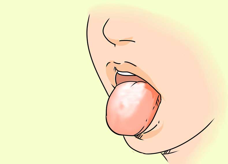 درمان طبیعی سفیدی زبان
