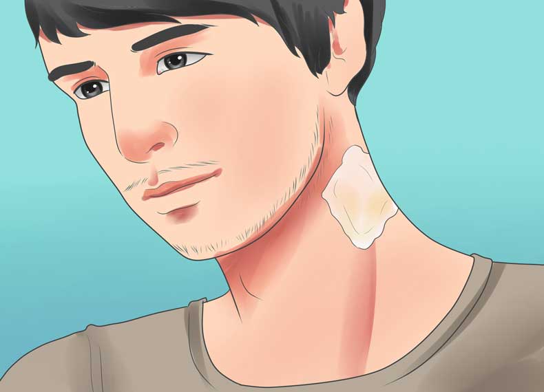 درمان ریش زیر پوستی