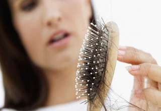 علت ریزش مو زنان