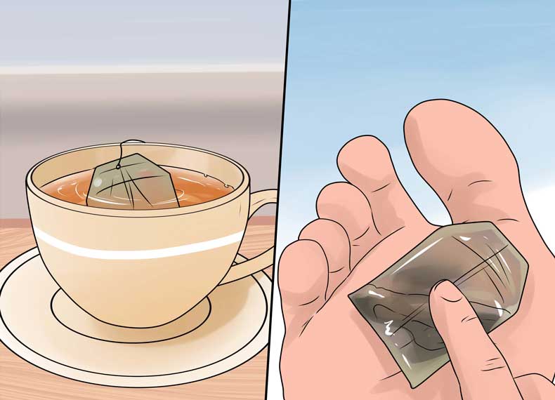 از بین بردن تاول با چای