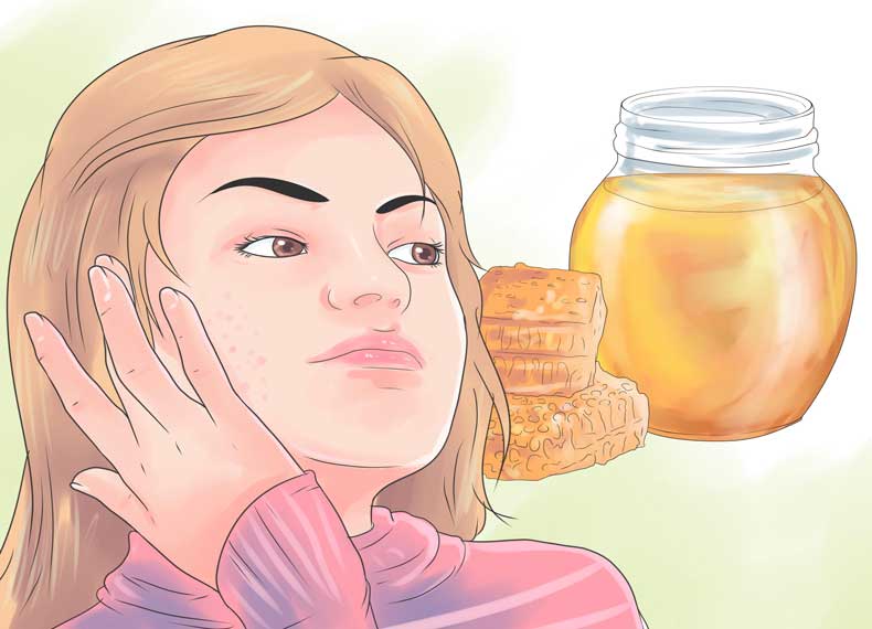 عسل و درمان جای جوش