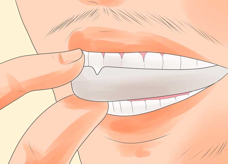 جلوگیری از آسیب به دندان