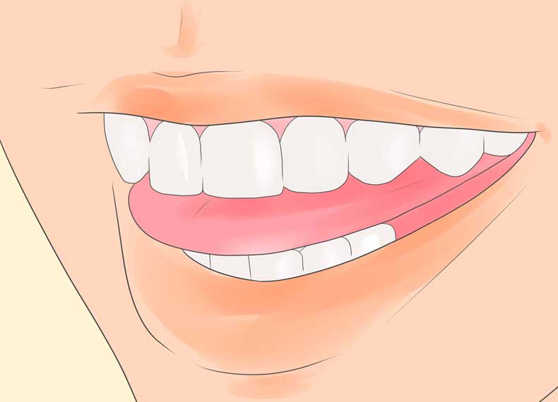 نشانه های دندان قروچه