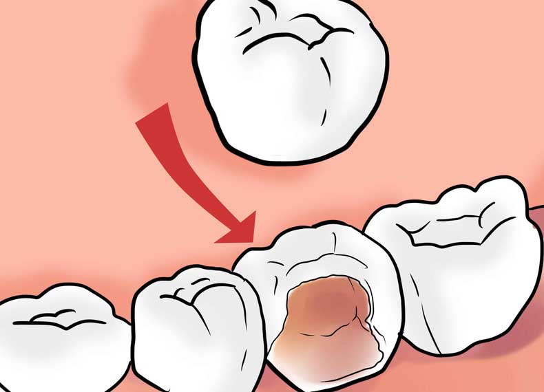 درد دندان عقبی