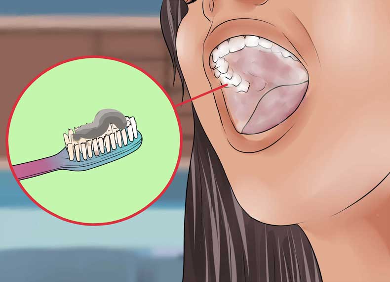 کاهش پوسیدگی دندان ها