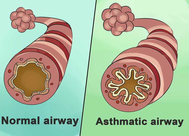 آشنایی با آسم