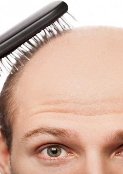 Reduce-Hair-Loss-www.koorook.com-14 درمان قطعی ریزش مو