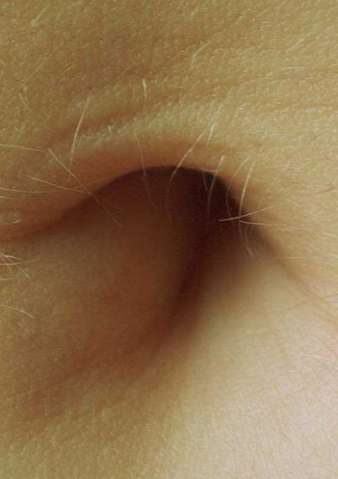 Treat-an-Infection-in-Your-Belly-Button-www.koorook.com-13 ناف