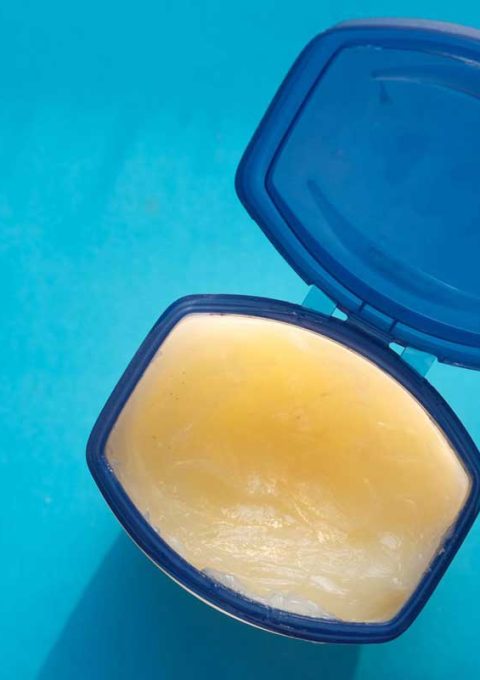 can-scabies-be-treated-with-vaseline66 درمان گال با وازلین