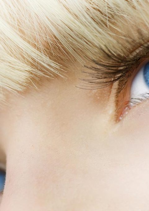 درمان پف زیر چشم