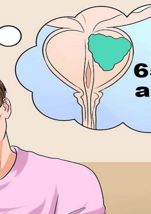 راههای جلوگیری از پروستات